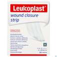 Wundverband Wundnahtstreifen/steril Leukoplast/weiss Closure Strip 12x100mm 12st, A-Nr.: 3478972 - 01