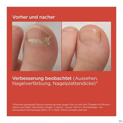 Sie sehen eine Packung Isdin Si-nails Micoxpert 4,5ml, Produktbild: 09 Isdin Si-nails Micoxpert 4,5ml, A-Nr.: 5744952 - 09