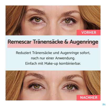 Sie sehen eine Packung Remescar Creme Traenensaecke +augenringe 8ml, Produktbild: 13 Remescar Creme Traenensaecke +augenringe 8ml, A-Nr.: 4554936 - 13