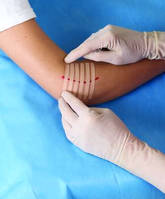 Nexcare™ Steri-Strip™ Wundverschlussstreifen, braun, 6 mm x 75 mm 6/Packung, A-Nr.: 5738029 - 03